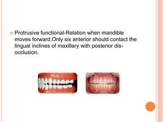Proclusive Balanced occlusion | PPTX