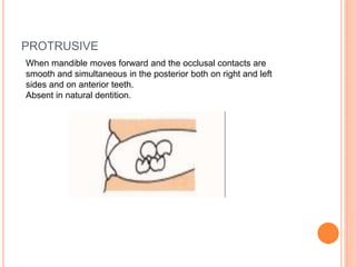 Proclusive Balanced occlusion | PPTX