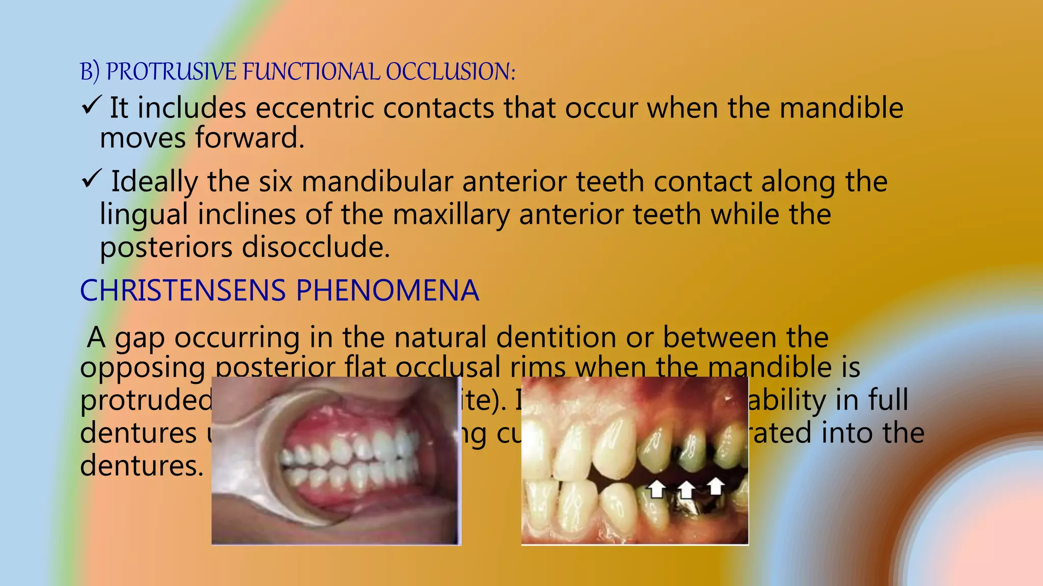 Tooth Disocclude Balanced occlusion | PPTX