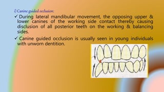Balanced occlusion | PPTX