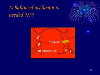 21
Is balanced occlusion is
needed ????
 