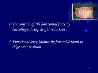 9
The control of the horizontal force by
buccolingual cusp height reduction .
Functional lever balance by favorable tooth to
ridge crest position
 