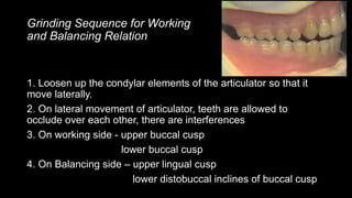 balanced occlusion in complete denture.pptx