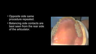 balanced occlusion in complete denture.pptx