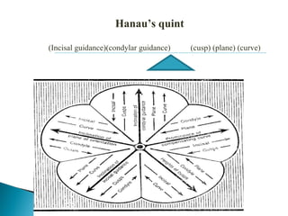 Hanau’s quint
(Incisal guidance)(condylar guidance) (cusp) (plane) (curve)
 