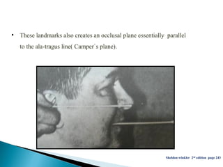 • These landmarks also creates an occlusal plane essentially parallel
to the ala-tragus line( Camper`s plane).
Sheldon winkler 2nd edition page 243
 