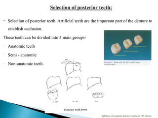  Selection of posterior teeth: Artificial teeth are the important part of the denture to
establish occlusion.
These teeth can be divided into 3 main groups-
- Anatomic teeth
- Semi - anatomic
- Non-anatomic teeth.
Syllabus of complete denture-Heartwell -4th
edition
 