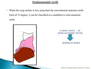  When the cusp incline is less steep than the conventional anatomic tooth
form of 33 degree, it can be classified as a modified or semi-anatomic
tooth.
CUSPAL ANGLE < 30°
(SEMI-ANATOMIC TEETH)
MODERATE RIDGE
Syllabus of complete denture-Heartwell -4th
edition
 