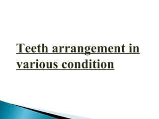 Teeth arrangement in
various condition
 