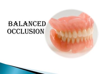 BALANCED
OCCLUSION
 