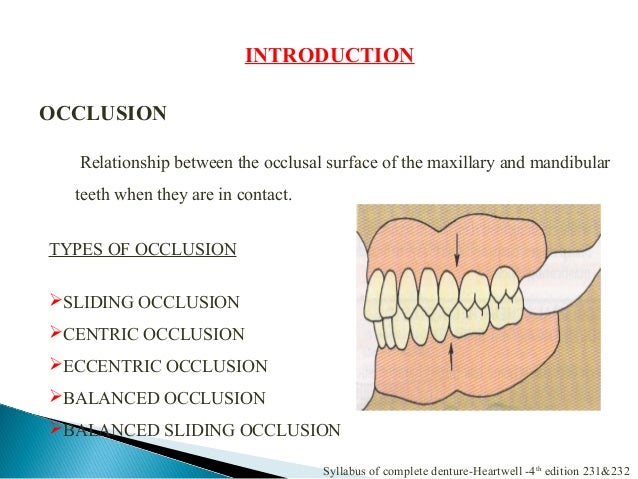 Occlusion definition in dentistry