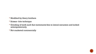  Modified by Avery brothers
 Scissor- bite technique
 Grinding of teeth such that movements free in lateral excursion and locked
anteroposteriorly.
 Not marketed commercially
 