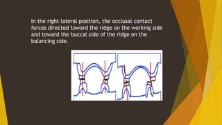 BALANCED OCCLUSION in complete denture prostho | PPTX