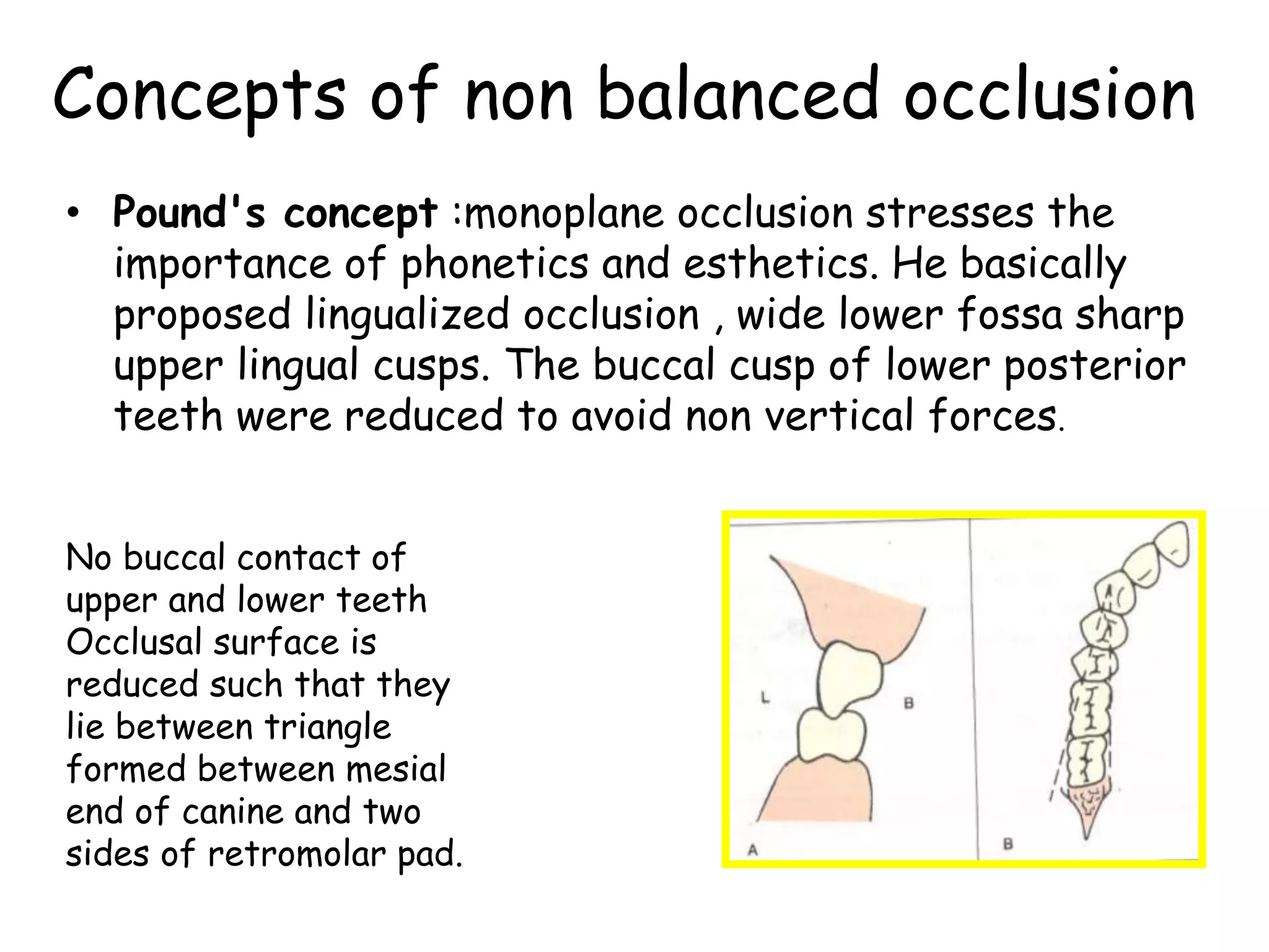 Concepts of non balanced occlusion 
• Pound's concept :monoplane occlusion stresses the 
importance of phonetics and esthetics. He basically 
proposed lingualized occlusion , wide lower fossa sharp 
upper lingual cusps. The buccal cusp of lower posterior 
teeth were reduced to avoid non vertical forces. 
No buccal contact of 
upper and lower teeth 
Occlusal surface is 
reduced such that they 
lie between triangle 
formed between mesial 
end of canine and two 
sides of retromolar pad. 
 