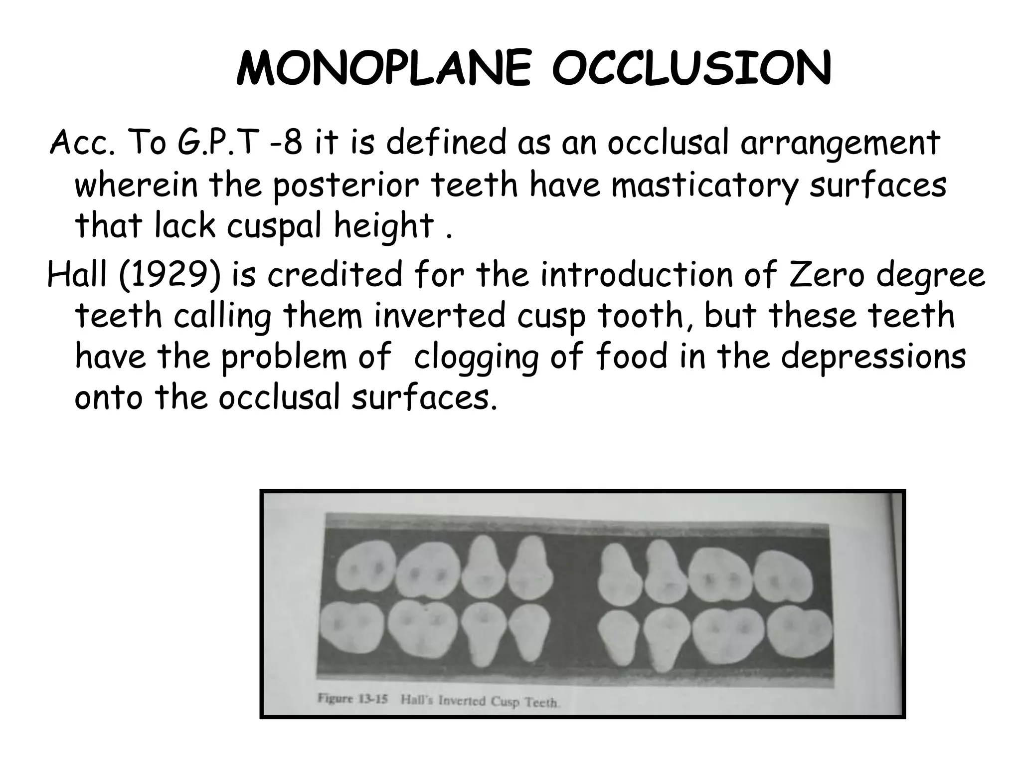 MONOPLANE OCCLUSION 
Acc. To G.P.T -8 it is defined as an occlusal arrangement 
wherein the posterior teeth have masticatory surfaces 
that lack cuspal height . 
Hall (1929) is credited for the introduction of Zero degree 
teeth calling them inverted cusp tooth, but these teeth 
have the problem of clogging of food in the depressions 
onto the occlusal surfaces. 
 