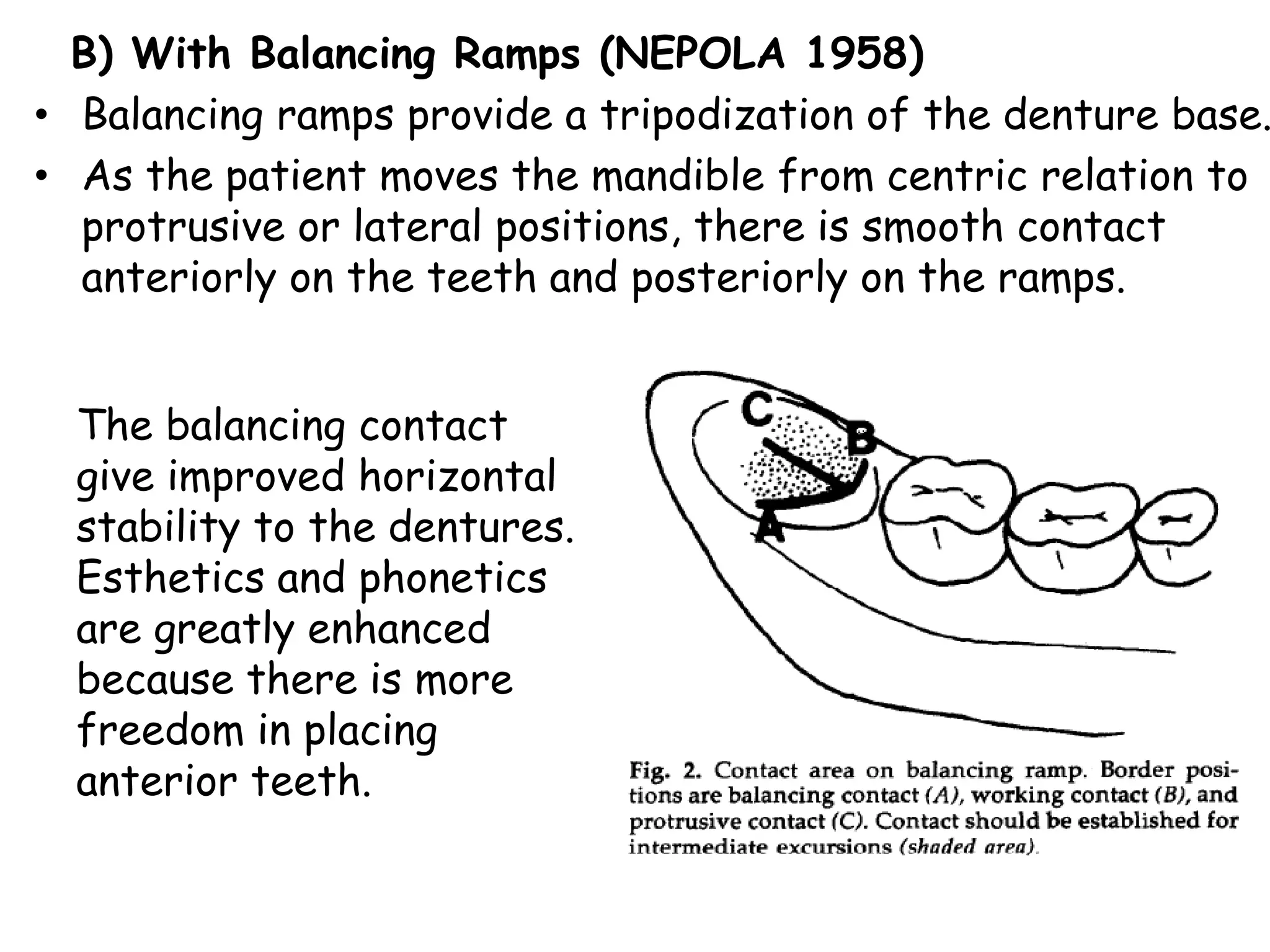 B) With Balancing Ramps (NEPOLA 1958) 
• Balancing ramps provide a tripodization of the denture base. 
• As the patient moves the mandible from centric relation to 
protrusive or lateral positions, there is smooth contact 
anteriorly on the teeth and posteriorly on the ramps. 
The balancing contact 
give improved horizontal 
stability to the dentures. 
Esthetics and phonetics 
are greatly enhanced 
because there is more 
freedom in placing 
anterior teeth. 
 