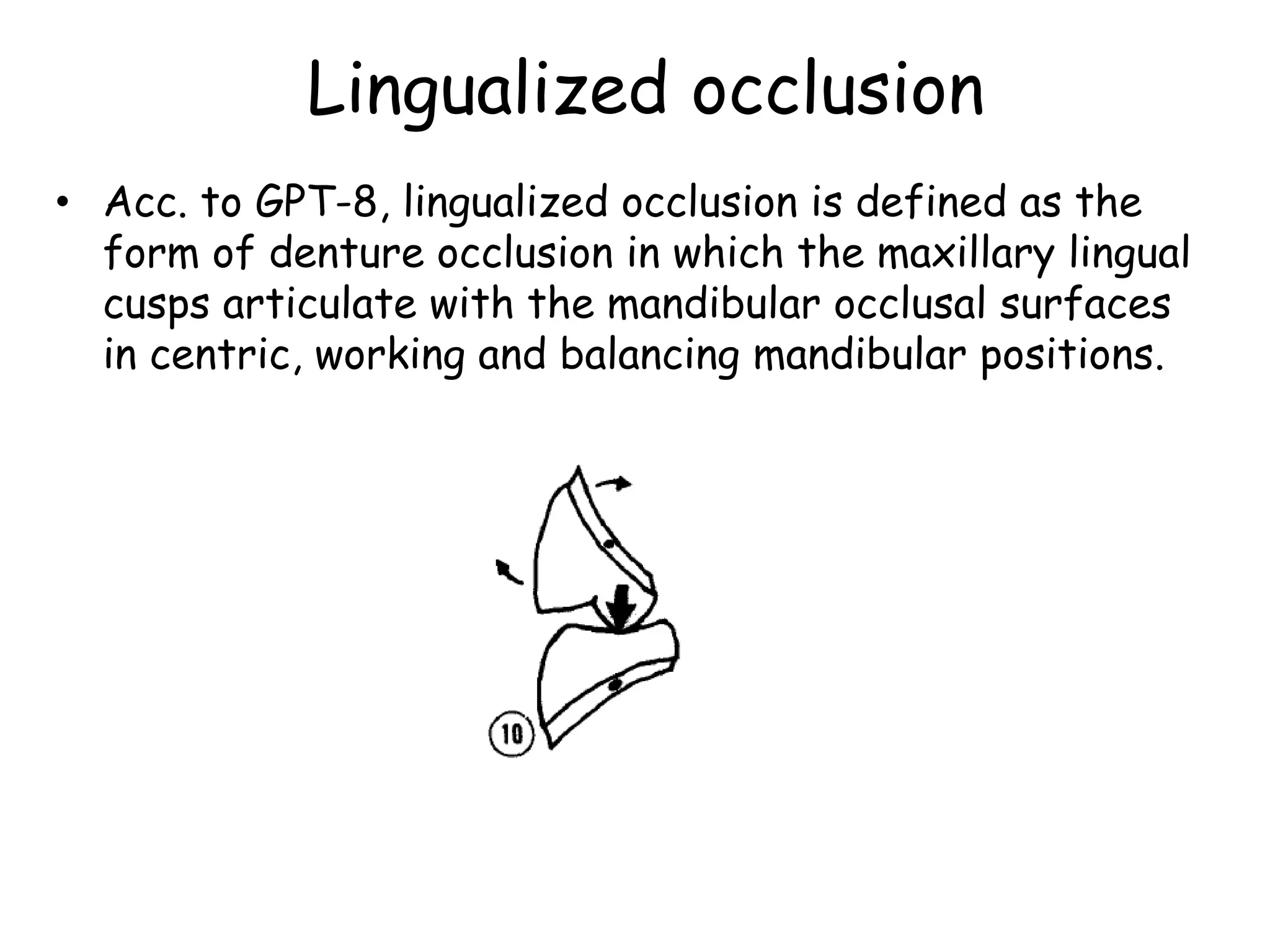 Lingualized occlusion 
• Acc. to GPT-8, lingualized occlusion is defined as the 
form of denture occlusion in which the maxillary lingual 
cusps articulate with the mandibular occlusal surfaces 
in centric, working and balancing mandibular positions. 
 