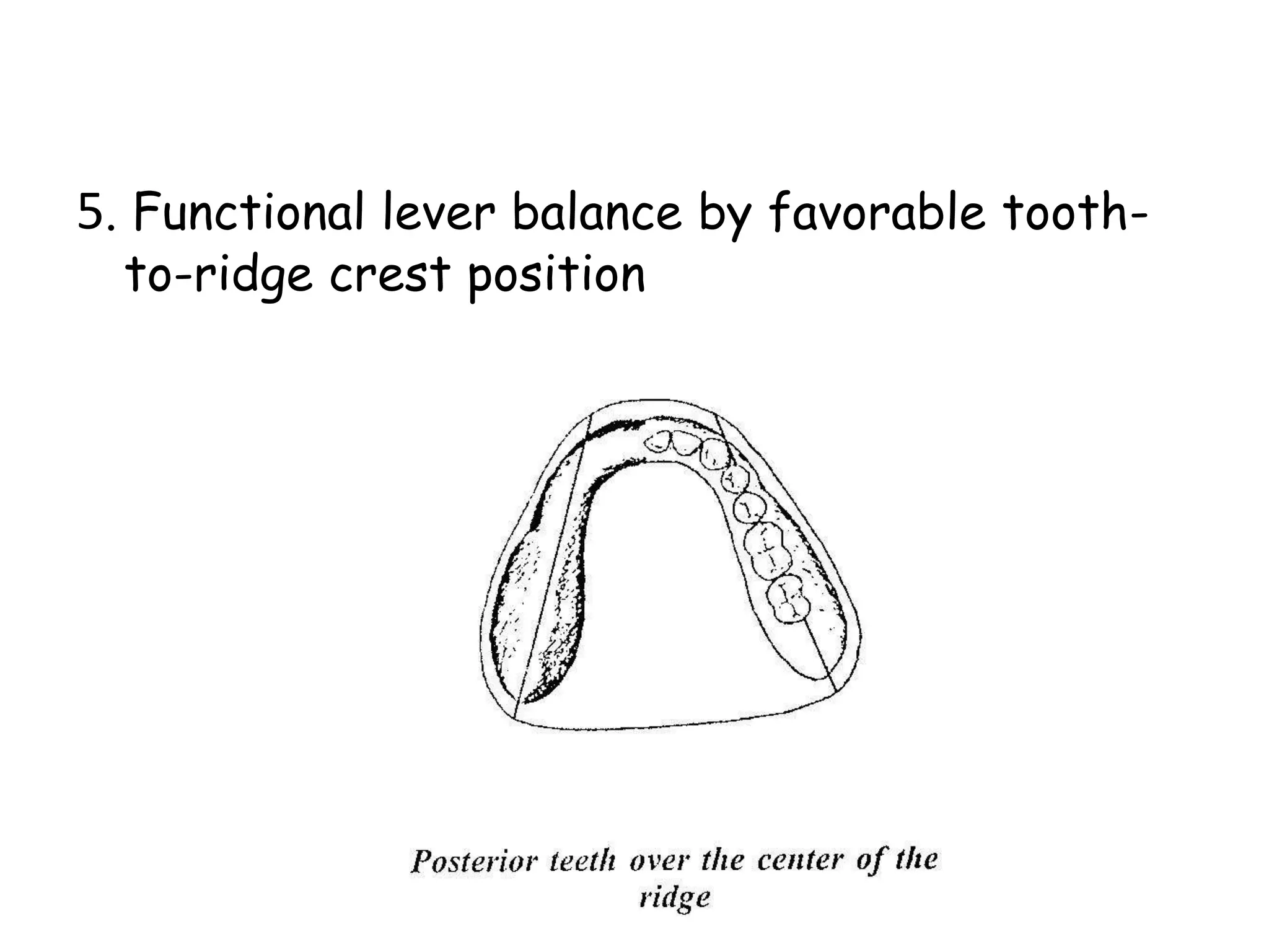 5. Functional lever balance by favorable tooth-to- 
ridge crest position 
 