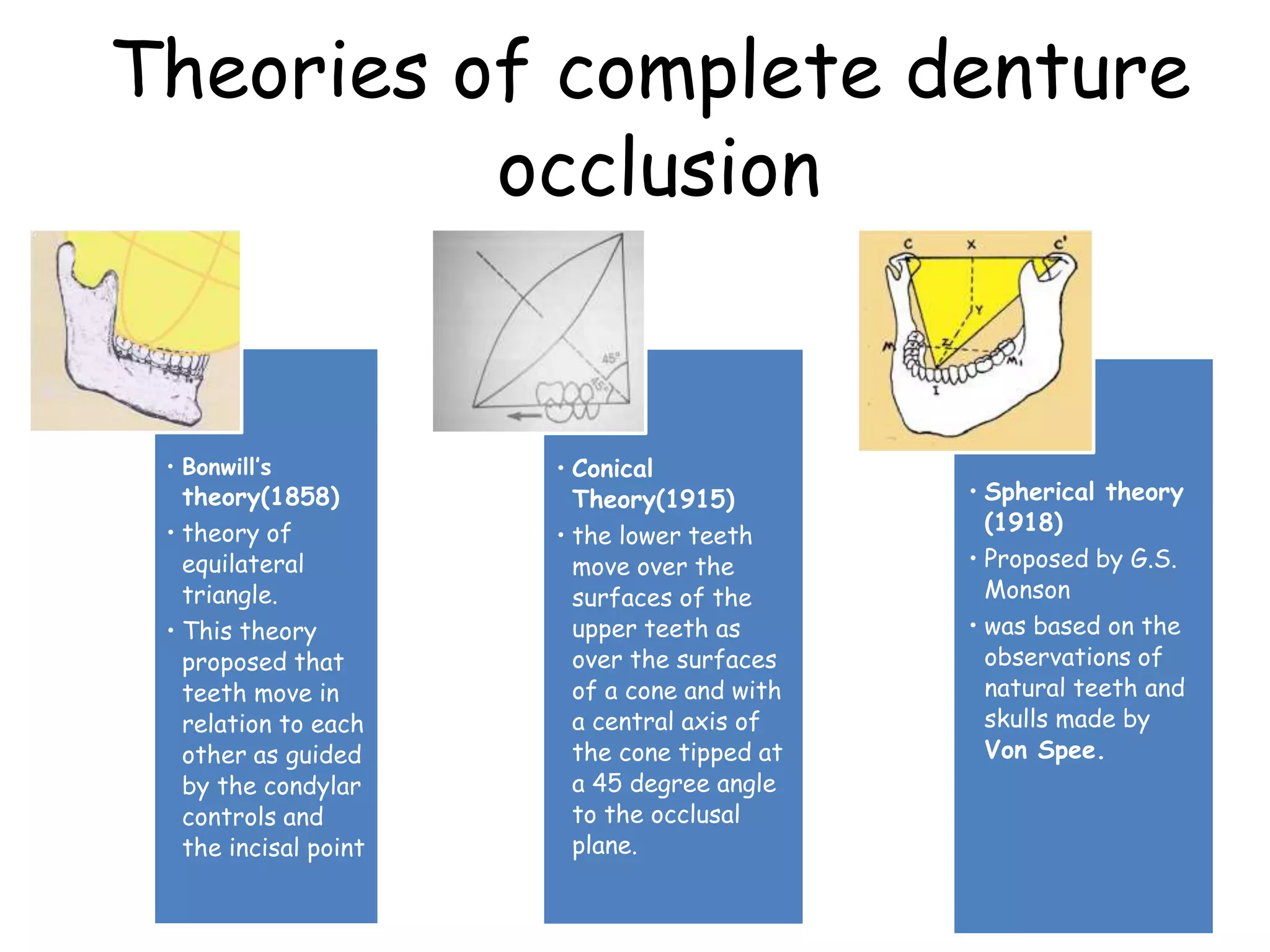 Theories of complete denture 
occlusion 
• Bonwill’s 
theory(1858) 
• theory of 
equilateral 
triangle. 
• This theory 
proposed that 
teeth move in 
relation to each 
other as guided 
by the condylar 
controls and 
the incisal point 
• Conical 
Theory(1915) 
• the lower teeth 
move over the 
surfaces of the 
upper teeth as 
over the surfaces 
of a cone and with 
a central axis of 
the cone tipped at 
a 45 degree angle 
to the occlusal 
plane. 
• Spherical theory 
(1918) 
• Proposed by G.S. 
Monson 
• was based on the 
observations of 
natural teeth and 
skulls made by 
Von Spee. 
 
