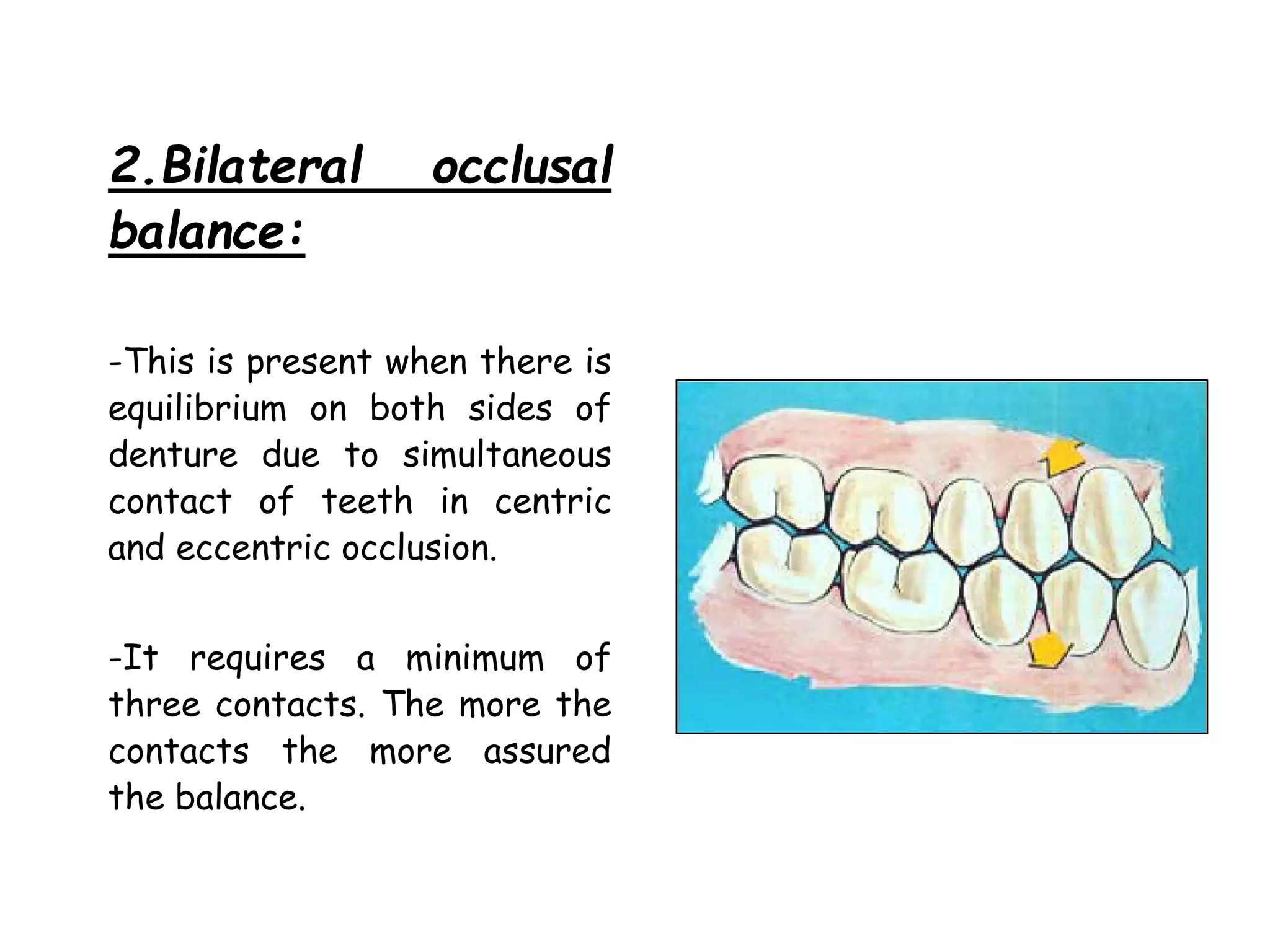 2.Bilateral occlusal 
balance: 
-This is present when there is 
equilibrium on both sides of 
denture due to simultaneous 
contact of teeth in centric 
and eccentric occlusion. 
-It requires a minimum of 
three contacts. The more the 
contacts the more assured 
the balance. 
 