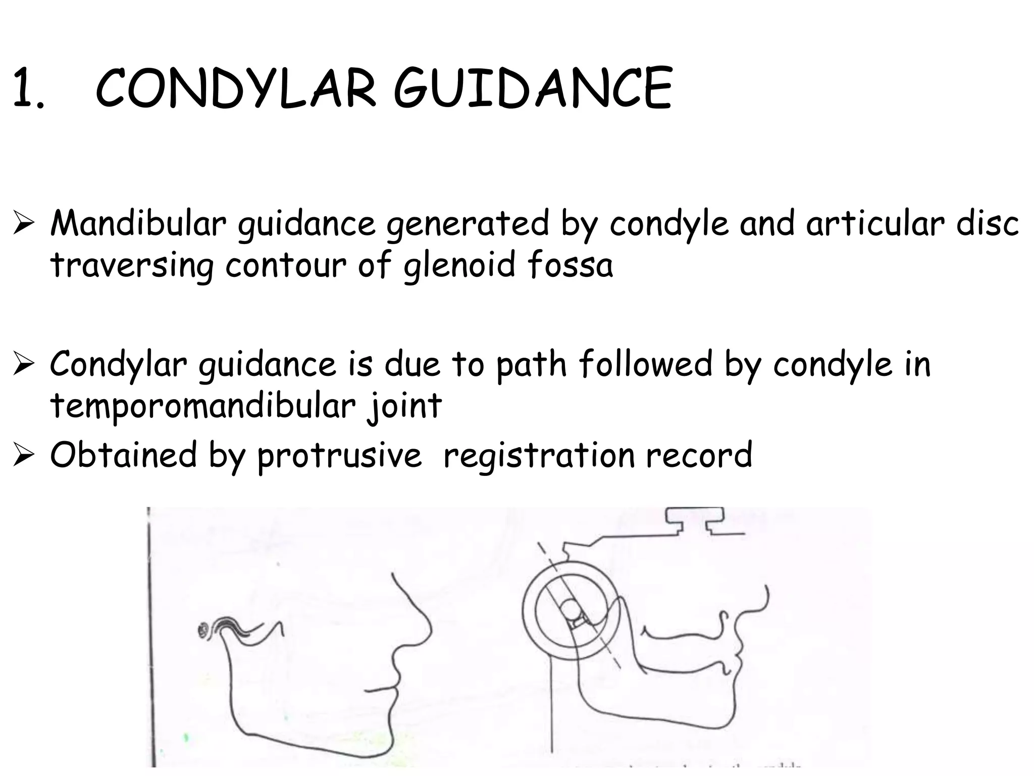 1. CONDYLAR GUIDANCE 
 Mandibular guidance generated by condyle and articular disc 
traversing contour of glenoid fossa 
 Condylar guidance is due to path followed by condyle in 
temporomandibular joint 
 Obtained by protrusive registration record 
 