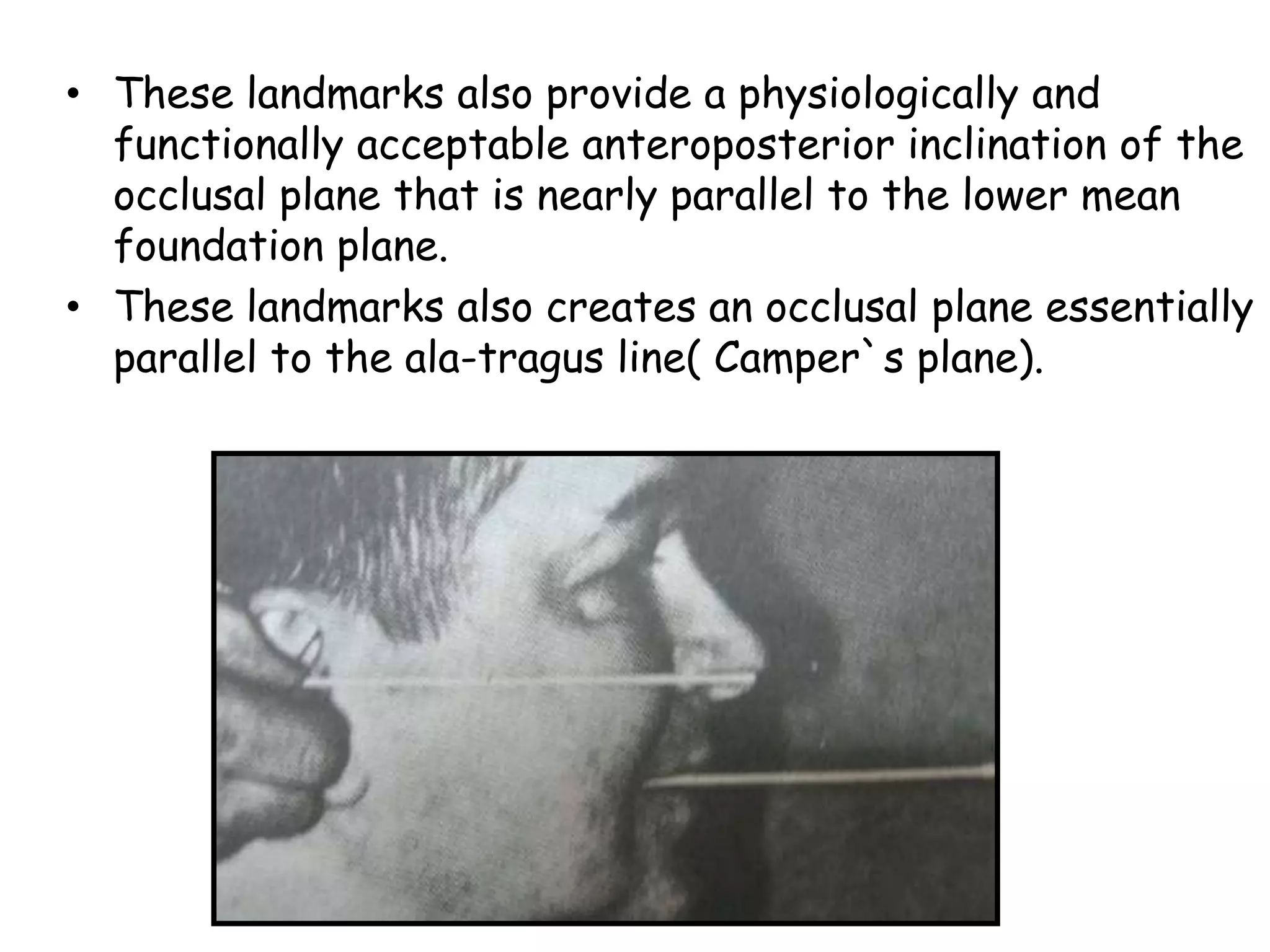 • These landmarks also provide a physiologically and 
functionally acceptable anteroposterior inclination of the 
occlusal plane that is nearly parallel to the lower mean 
foundation plane. 
• These landmarks also creates an occlusal plane essentially 
parallel to the ala-tragus line( Camper`s plane). 
 