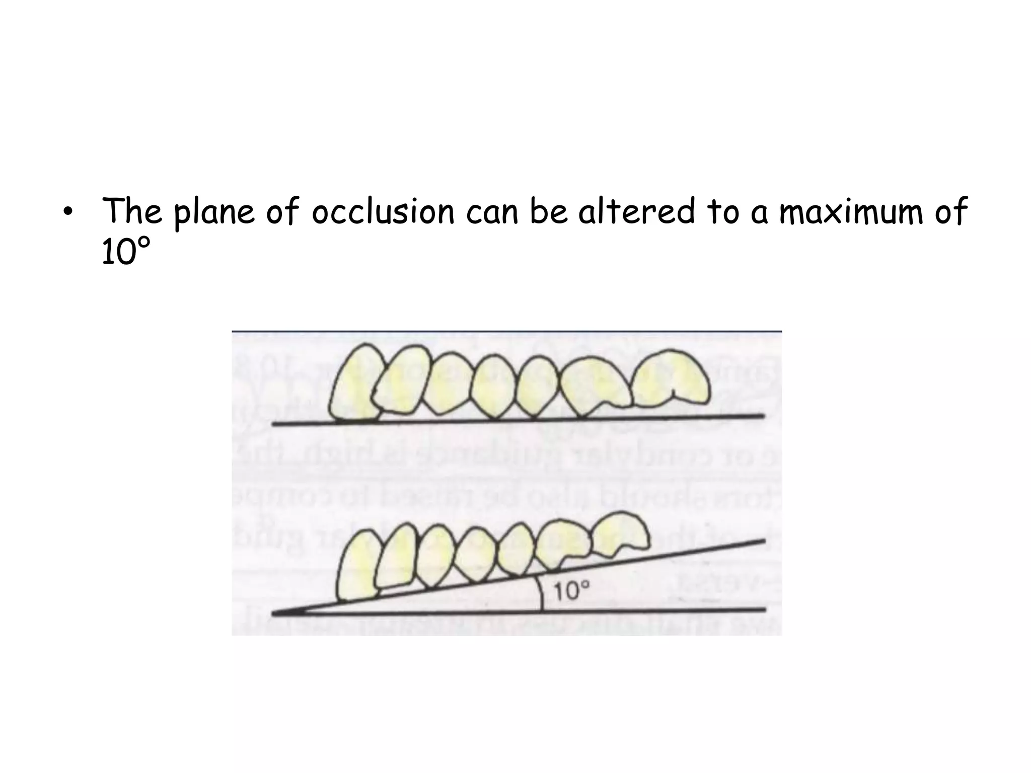 • The plane of occlusion can be altered to a maximum of 
10° 
 