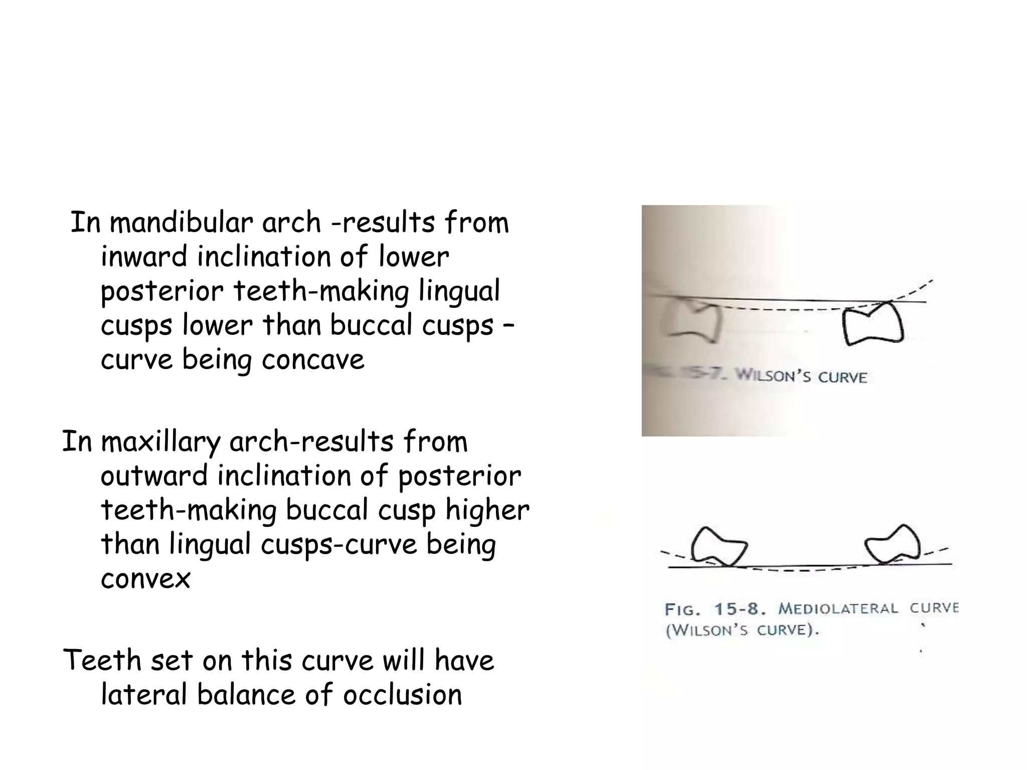 In mandibular arch -results from 
inward inclination of lower 
posterior teeth-making lingual 
cusps lower than buccal cusps – 
curve being concave 
In maxillary arch-results from 
outward inclination of posterior 
teeth-making buccal cusp higher 
than lingual cusps-curve being 
convex 
Teeth set on this curve will have 
lateral balance of occlusion 
 