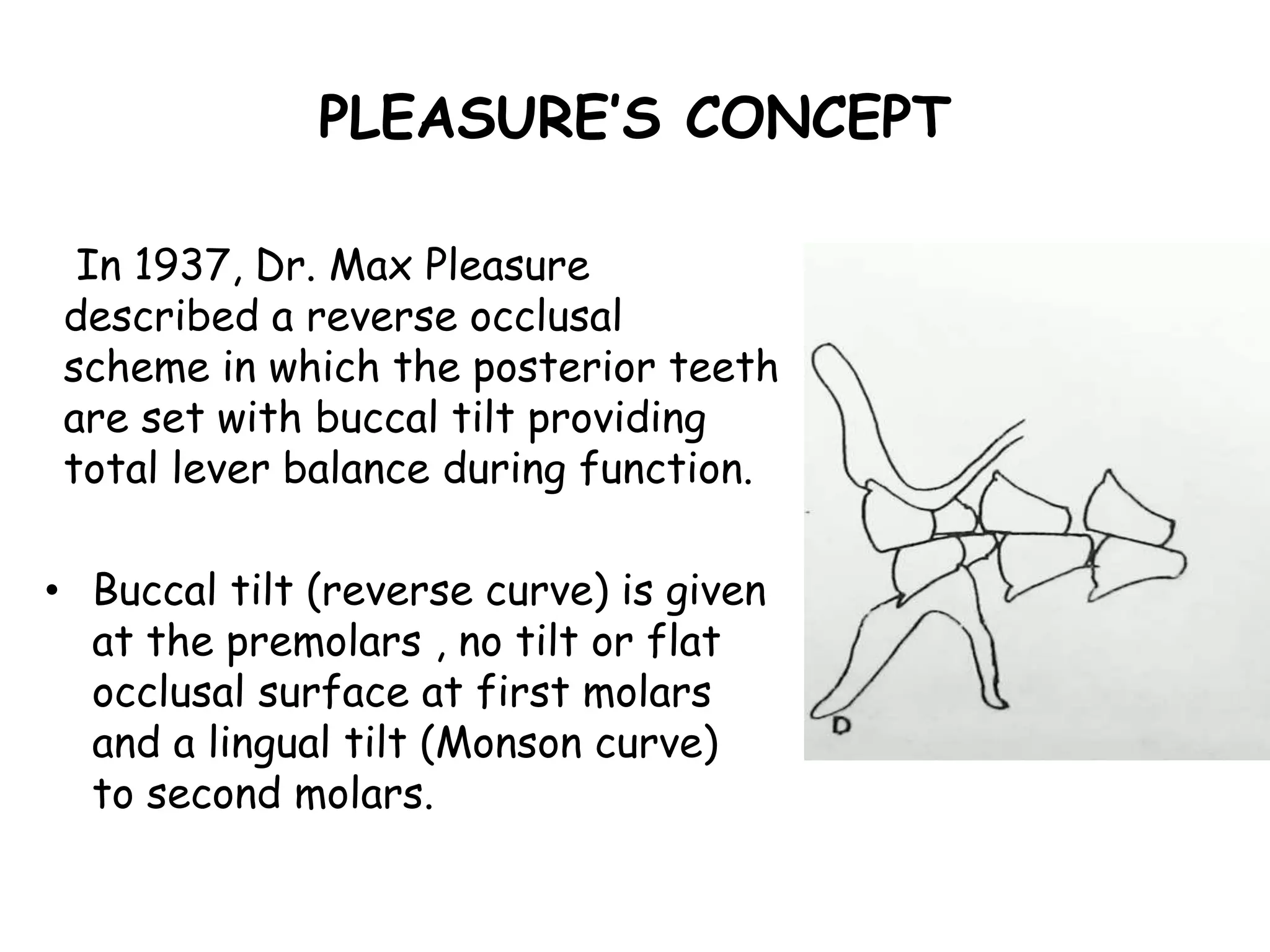 PLEASURE’S CONCEPT 
In 1937, Dr. Max Pleasure 
described a reverse occlusal 
scheme in which the posterior teeth 
are set with buccal tilt providing 
total lever balance during function. 
• Buccal tilt (reverse curve) is given 
at the premolars , no tilt or flat 
occlusal surface at first molars 
and a lingual tilt (Monson curve) 
to second molars. 
 
