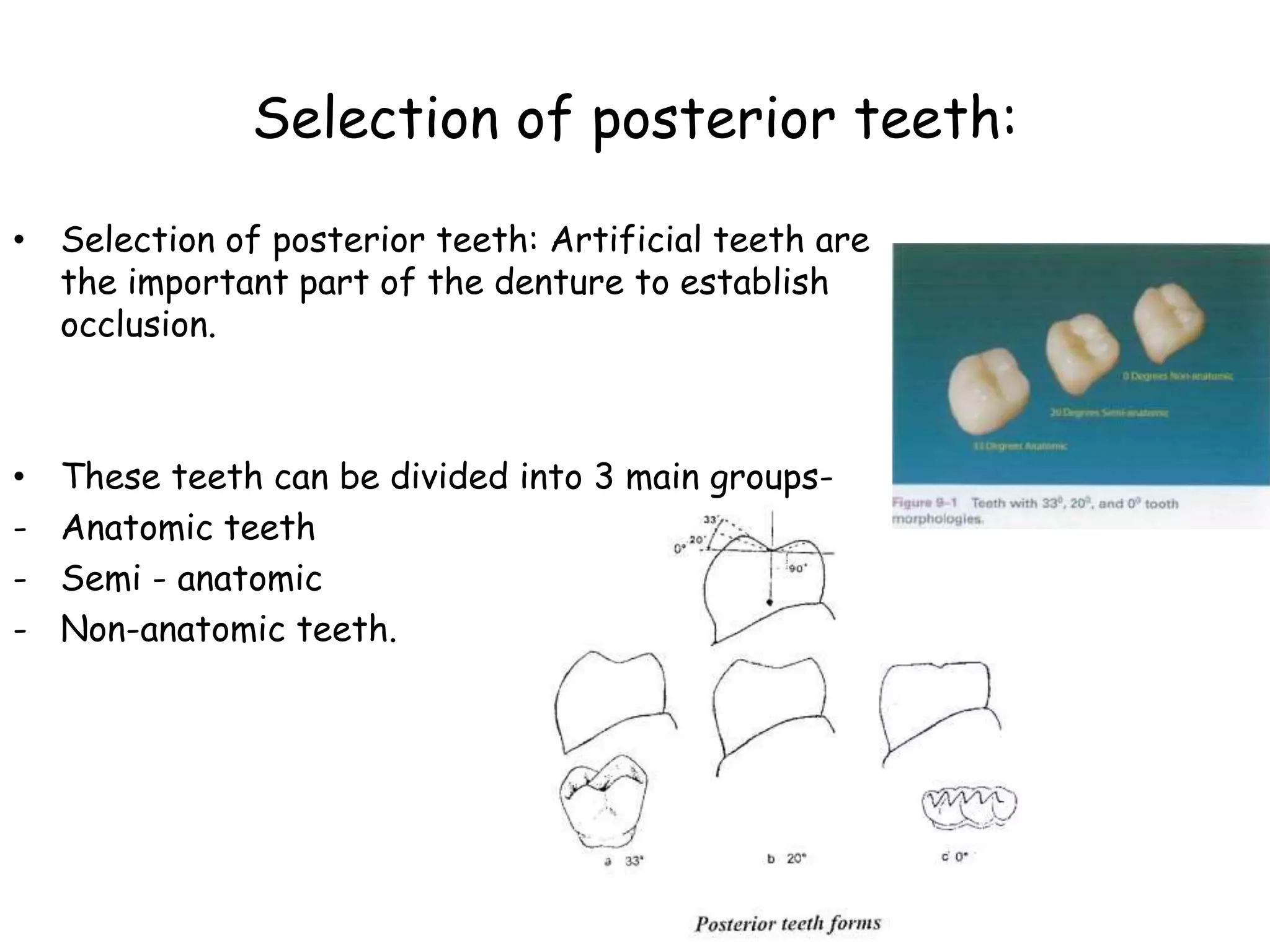 Selection of posterior teeth: 
• Selection of posterior teeth: Artificial teeth are 
the important part of the denture to establish 
occlusion. 
• These teeth can be divided into 3 main groups- 
- Anatomic teeth 
- Semi - anatomic 
- Non-anatomic teeth. 
 