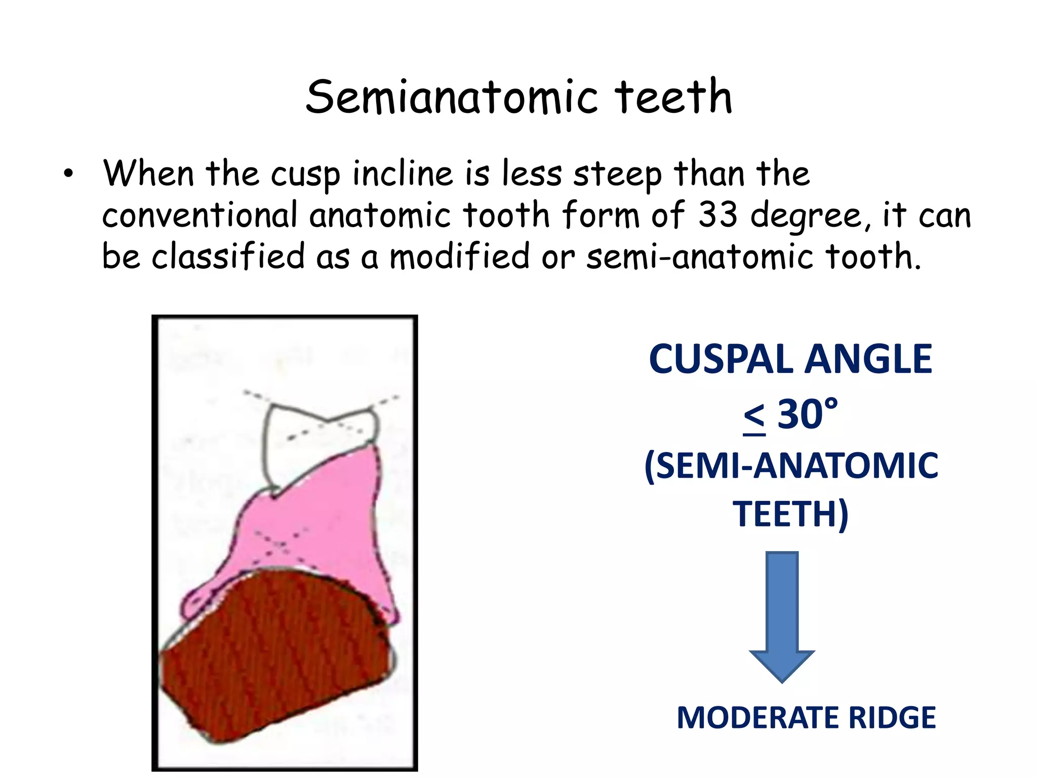 Semianatomic teeth 
• When the cusp incline is less steep than the 
conventional anatomic tooth form of 33 degree, it can 
be classified as a modified or semi-anatomic tooth. 
CUSPAL ANGLE 
< 30° 
(SEMI-ANATOMIC 
TEETH) 
MODERATE RIDGE 
 