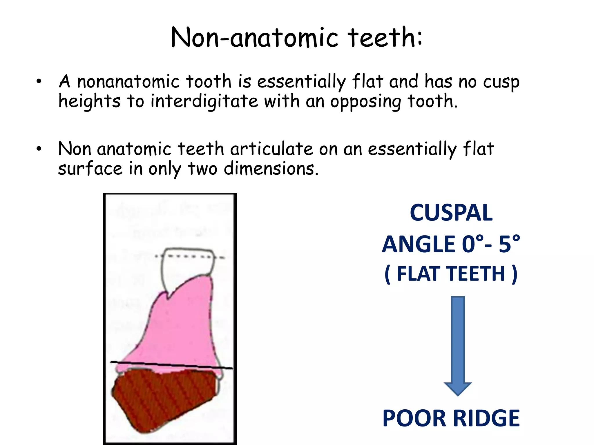Non-anatomic teeth: 
• A nonanatomic tooth is essentially flat and has no cusp 
heights to interdigitate with an opposing tooth. 
• Non anatomic teeth articulate on an essentially flat 
surface in only two dimensions. 
CUSPAL 
ANGLE 0°- 5° 
( FLAT TEETH ) 
POOR RIDGE 
 