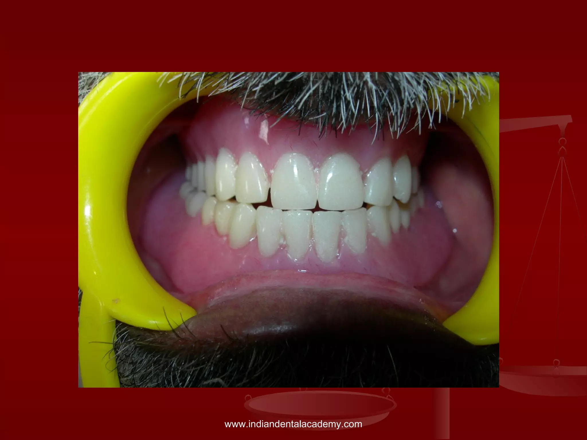 www.indiandentalacademy.com
 