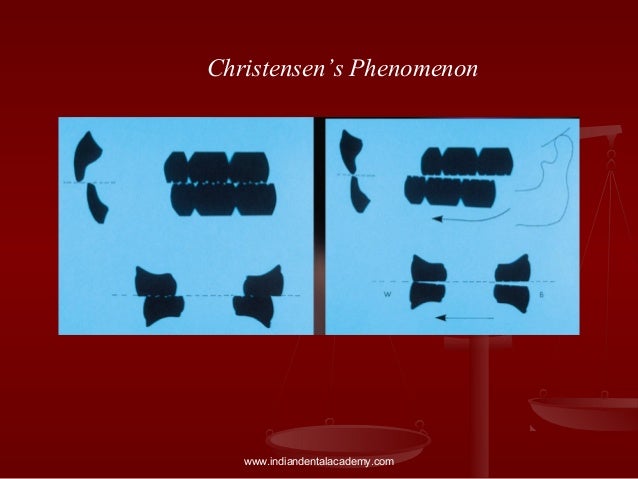 Balanced occlusion and its importance/ cosmetic dentistry training