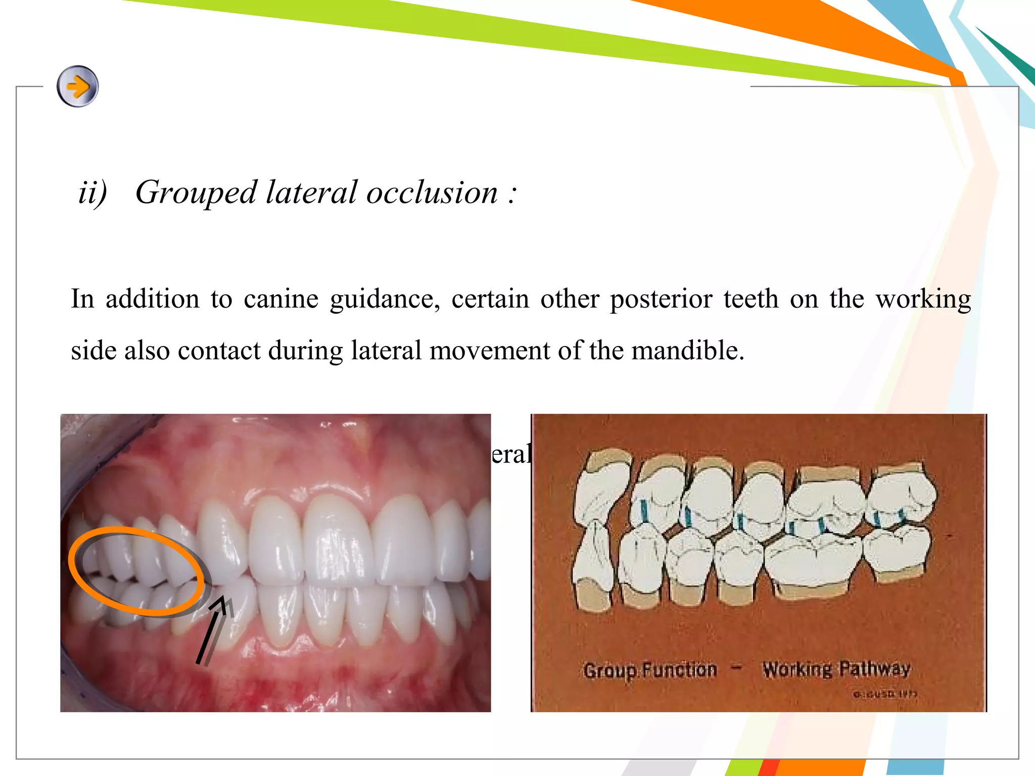 Balanced occlusion and its importance PPT