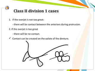 Class II division 1 cases
1. If the overjet is not too great:
- there will be contact between the anteriors during protrusion.
2. If the overjet is too great
- there will be no contact.
 Contact can be created on the palate of the denture.
 