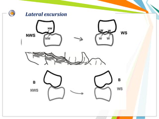 Lateral excursion
 
