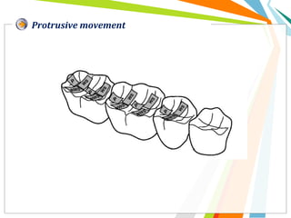 Protrusive movement
 
