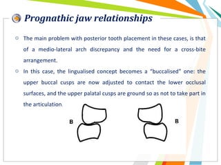 Prognathic jaw relationships
o The main problem with posterior tooth placement in these cases, is that
of a medio-lateral arch discrepancy and the need for a cross-bite
arrangement.
o In this case, the lingualised concept becomes a “buccalised” one: the
upper buccal cusps are now adjusted to contact the lower occlusal
surfaces, and the upper palatal cusps are ground so as not to take part in
the articulation.
 
