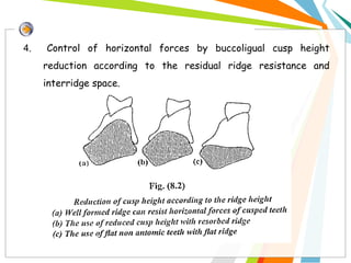 4. Control of horizontal forces by buccoligual cusp height
reduction according to the residual ridge resistance and
interridge space.
 
