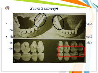 Sears’s concept
• In 1922 & 1927, “Channel” tooth. To permit unlimited
protrusive glide .
• He proposed the balanced occlusion for non-anatomic teeth
using posterior balancing ramps or an occlusal plane which
curves anteroposteriorly & laterally.
 