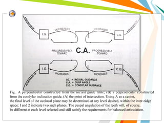 Fig.. A perpendicular constructed from the incisal guide table; (B) a perpendicular constructed
from the condylar inclination guide; (A) the point of intersection. Using A as a center,
the final level of the occlusal plane may be determined at any level desired, within the inter-ridge
space: I and 2 indicate two such planes. The cuspal angulation of the teeth will, of course,
be different at each level selected and still satisfy the requirements for balanced articulation.
 