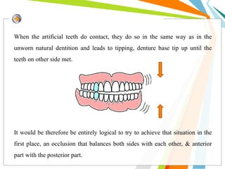 When the artificial teeth do contact, they do so in the same way as in the
unworn natural dentition and leads to tipping, denture base tip up until the
teeth on other side met.
It would be therefore be entirely logical to try to achieve that situation in the
first place, an occlusion that balances both sides with each other, & anterior
part with the posterior part.
 