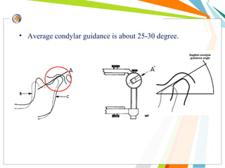• Average condylar guidance is about 25-30 degree.
 