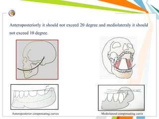 Anteroposteriorly it should not exceed 20 degree and mediolateraly it should
not exceed 10 degree.
Anteroposterior compensating curves Mediolateral compensating curve
 