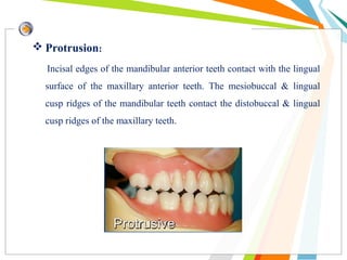  Protrusion:
Incisal edges of the mandibular anterior teeth contact with the lingual
surface of the maxillary anterior teeth. The mesiobuccal & lingual
cusp ridges of the mandibular teeth contact the distobuccal & lingual
cusp ridges of the maxillary teeth.
 