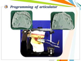 Programming of articulator
 