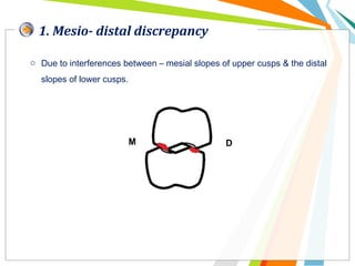 1. Mesio- distal discrepancy
o Due to interferences between – mesial slopes of upper cusps & the distal
slopes of lower cusps.
 