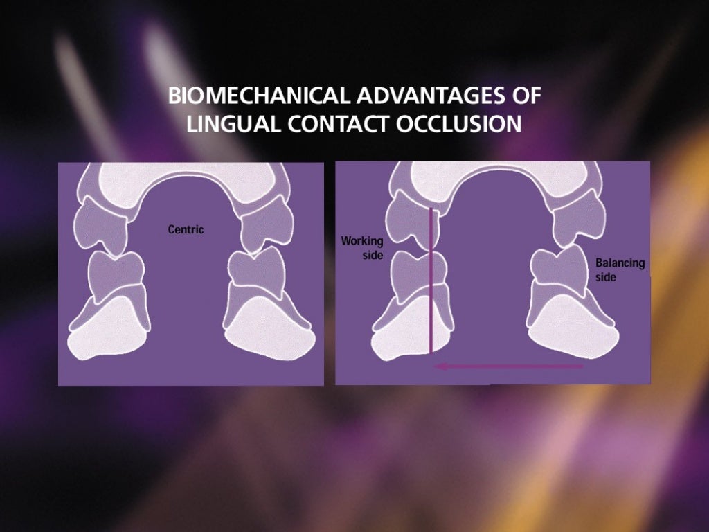 Balanced occlusion and its importance