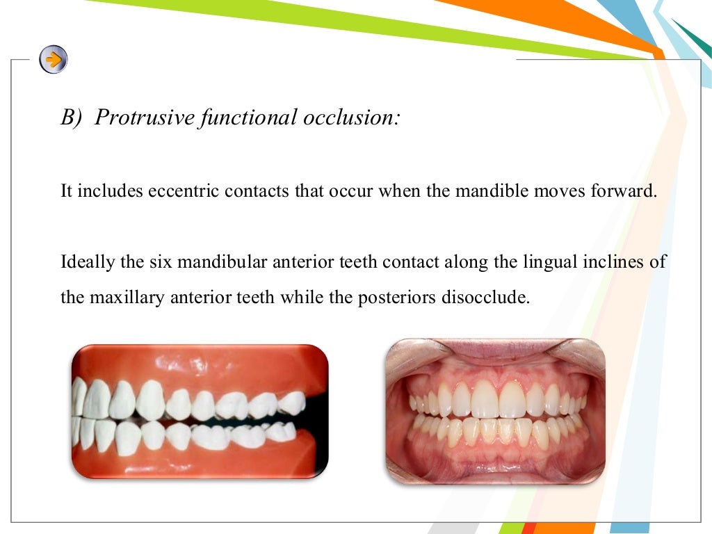 Balanced occlusion and its importance